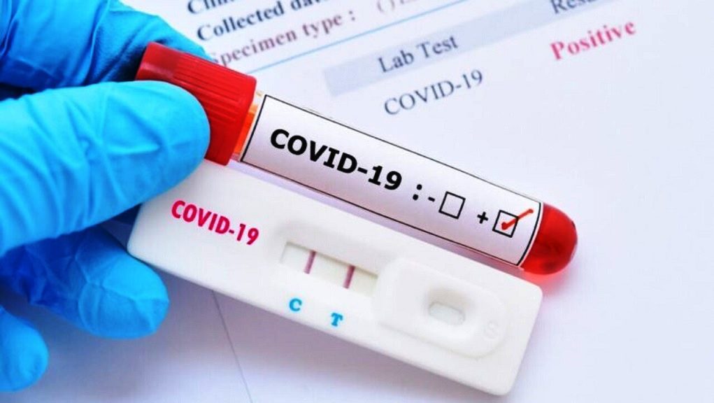 Πρόγραμμα test Covid-19 από την Κ.Ομ.Υ. Κω από τη Δευτέρα 20 Μαρτίου έως και την Παρασκευή 24 Μαρτίου.